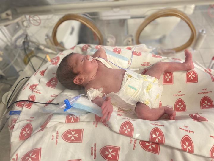 Geboren mit nur 27 Wochen im Holy Family Hospital: Jetzt wurde Baby Lilian entlassen
