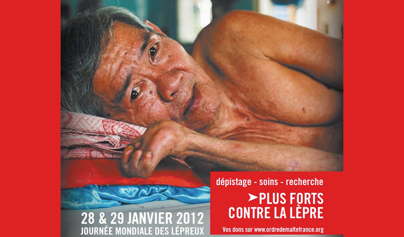 59th World Leprosy Day